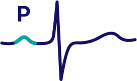 CONTOUR ECG ANALYSIS