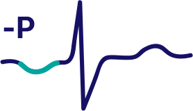 CONTOUR ECG ANALYSIS