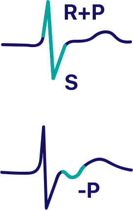 CONTOUR ECG ANALYSIS